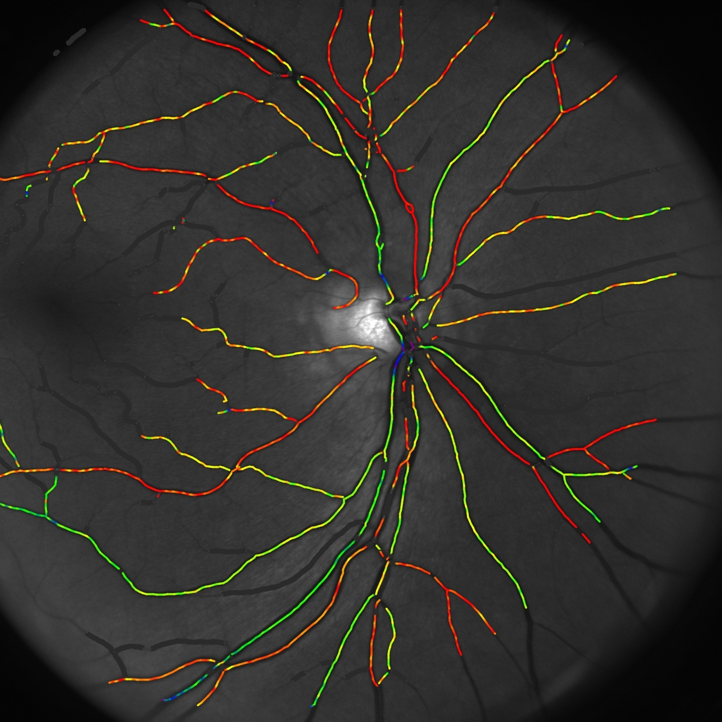 demcon-focal-case-diagnosing of blinding diseases-Corimap