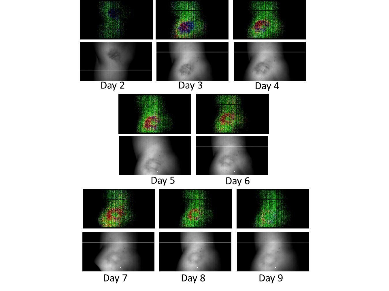 focal-case-exit bruise age (1)